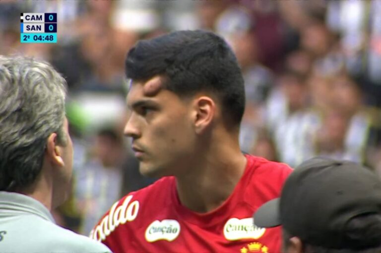 Brazão, do Santos, deixa campo de maca após joelhada na cabeça